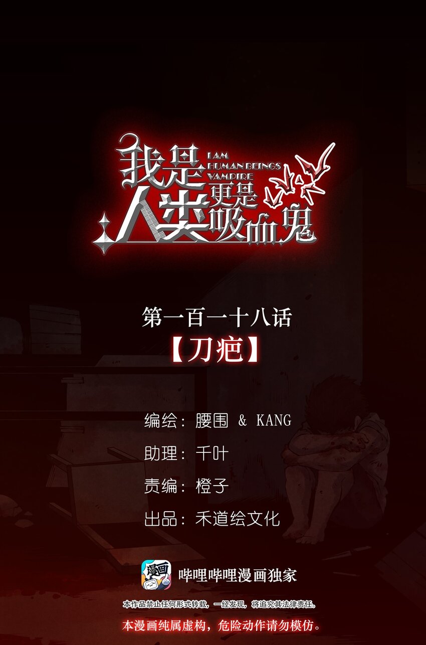 我是人類，更是吸血鬼 - 118 刀疤(1/2) - 1